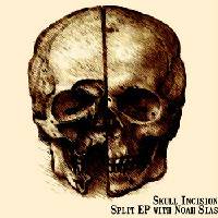 Skull Incision : Skull Incision and Noah Sias